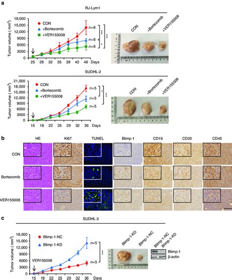 An Hsp Inhibitor Suppresses The In Vivo Growth Of Abc Dlbcl Cells