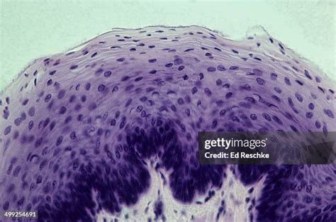 Stratified Squamous Epithelium Keratinized 400x