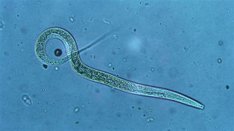 Root-Knot Nematode - Environmental Factor