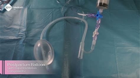 Uterine Balloon Tamponade For Pph Postpartum Balloon With Rapid