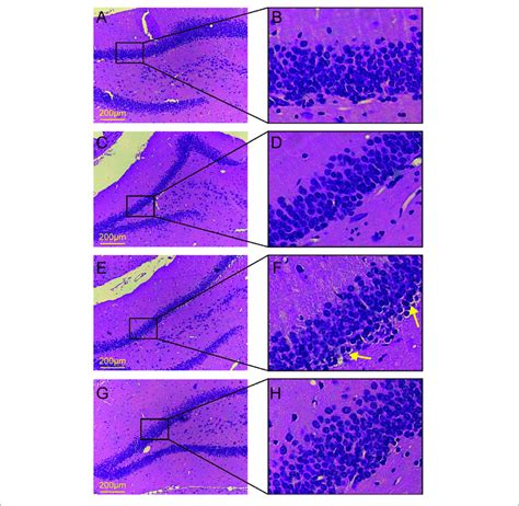 He Staining Of The Dentate Gyrus In The Hippocampus Ab Control