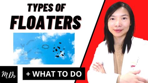 THREE Common Causes Of Floaters Explained MUST Watch YouTube