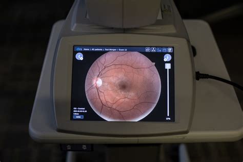 Improving Diabetic Care A Guide To Diabetic Retinal Screenings