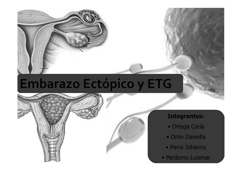 Embarazo Ectópico Y Etg Ppt