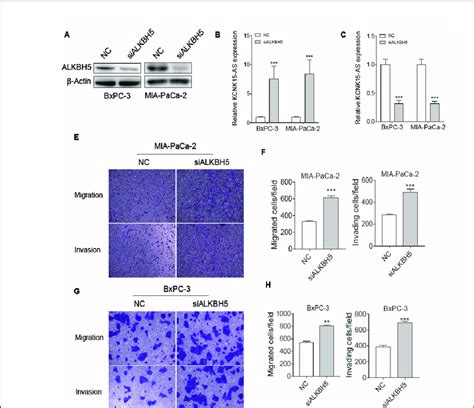 Influence Of Alkbh Knockdown On Kcnk As Mediated Cell Migration And