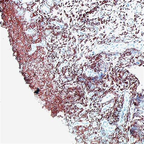 Cd163 Macrophages In The Intimal Lining And Sublining Layer Of Download Scientific Diagram