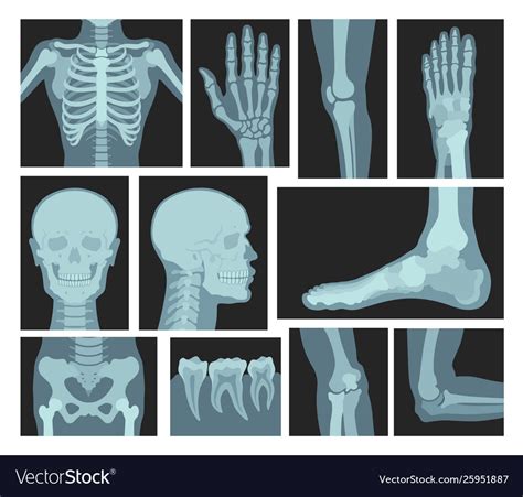 X Rays Human Body Medical Equipment Royalty Free Vector