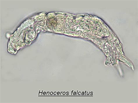 Key To Genera Of Bdelloid Rotifers