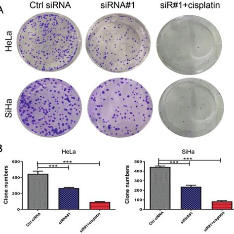 Effect Of GMPS Knockdown On The Senescence And Apoptosis Of CC Cells