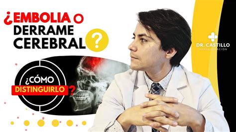 Embolia o derrame cerebral Qué hacer si sufriste un infarto cerebral