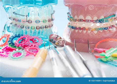 Herramientas Del Dentista Y Modelo Ortod Ntico Imagen De Archivo