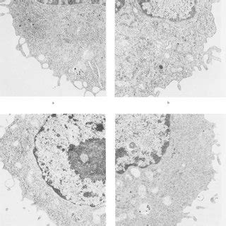 Internal Morphology Of Irradiated Cells 24 H After Irradiation A B C