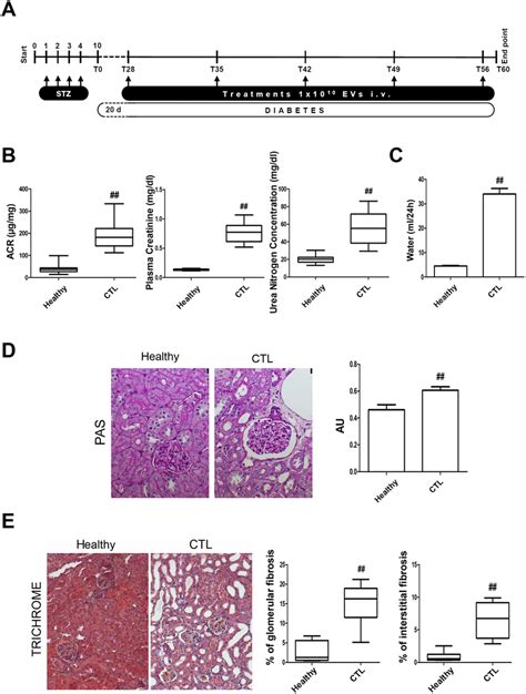 Induction Of Diabetic Nephropathy In Nsg Mice By Stz Injection A