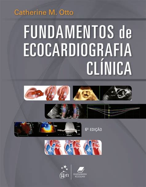 Fundamentos De Ecocardiografia Cl Nica Ebook Catherine M Otto