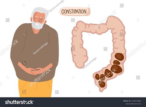 Abdominal Pain Due Constipation Intestine Constipation Stock Vector