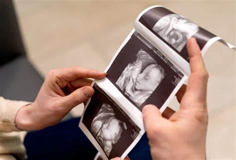 What Is The Difference Between 2d 3d 4d Ultrasounds