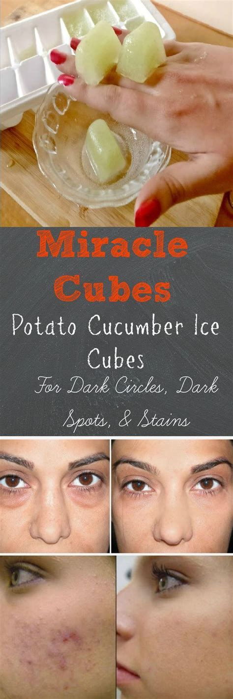 Hair Removal Permanent Facials POTATO CUCUMBER ICE CUBES FOR DARK SPOTS