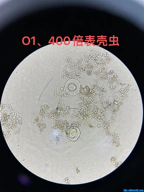 今日镜检表壳虫分享 微生物镜检 污托邦社区