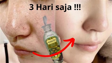 Inilah Cara Membuat Wajah Glowing Permanen Dengan Minyak Zaitun