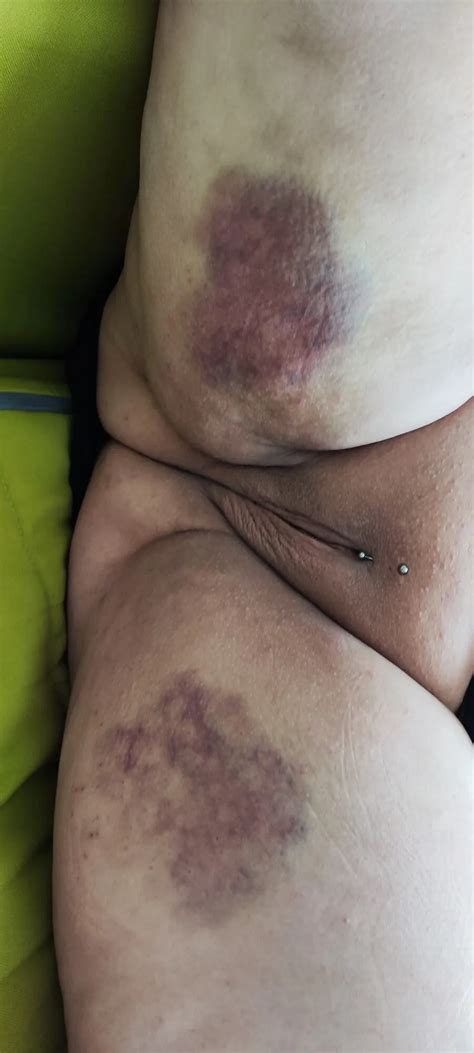 Darf Ich Mich Vorstellen Nude Pics Xhamster