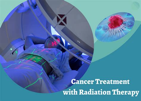 Radiation Therapy With Cancer Treatment