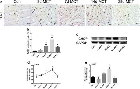 Rv Cardiomyocyte Apoptosis Induced By Er Stress A B Representative