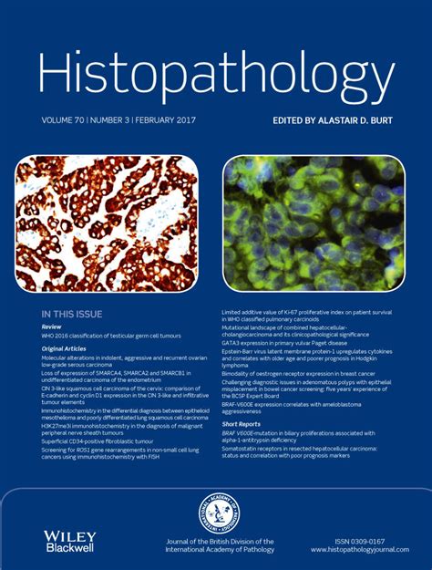 Cervical Intraepithelial Neoplasia Cin 3‐like Squamous Cell Carcinoma