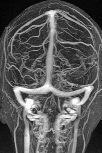 Accurate Venography CT Scan in Pune | Surya Diagnostic