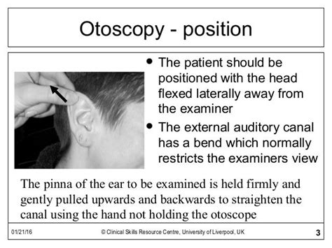 Otoscopy