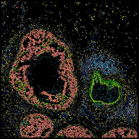 Human Breast Dataset Explorer 10x Genomics