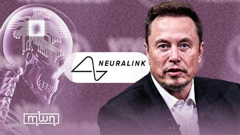 Elon Musk S Neuralink Hits Milestone With First Human Brain Chip