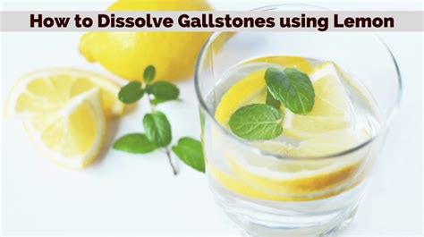 How To Dissolve Gallstones Using Lemon