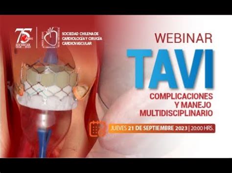 Webinar TAVI Complicaciones Y Manejo Multidisciplinario YouTube