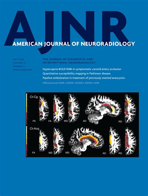 Improved Lesion Detection By Using Axial T2 Weighted MRI With Full