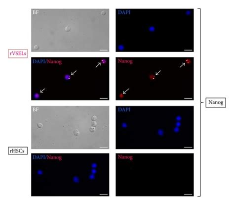 Expression Of Oct 4A And Nanog In Sorted Fractions Of RVSELs