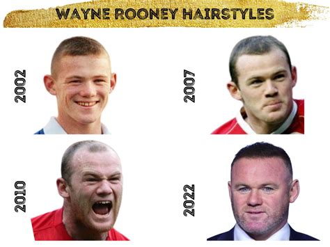 Wayne Rooney Hair Transplant - Hair Loss & Technical Analysis