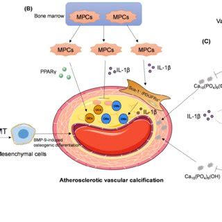 Vascular Calcification In Cardiovascular Vessels And Valves A And