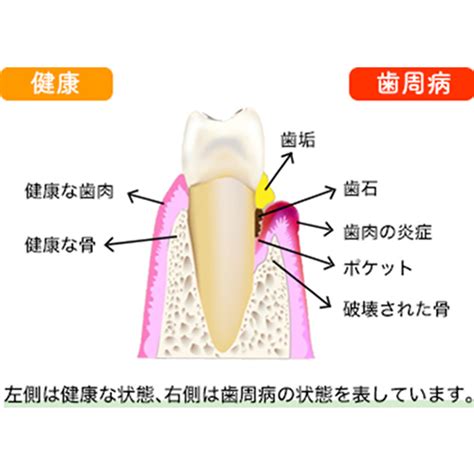 歯周病治療 たなか歯科医院