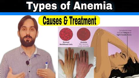 Anemia Causes