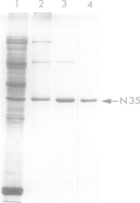 Sds Gel Electrophoresis Of Proteins At Different Purification Steps