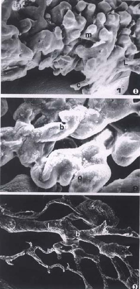 Figure 1 From Three Dimensional Structure Of Lymphatics In Rabbit