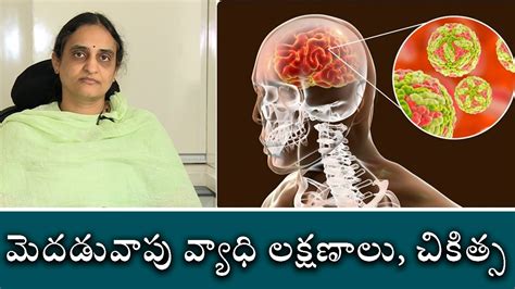 Japanese encephalitis Symptoms Treatment మదడవప వయధ లకష