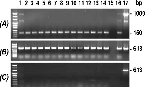 Rt Pcr Analysis Of Transgene Mrna Expression In Different Tissues Of