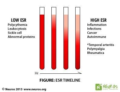 Medtech Knows On Twitter High And Low Esr