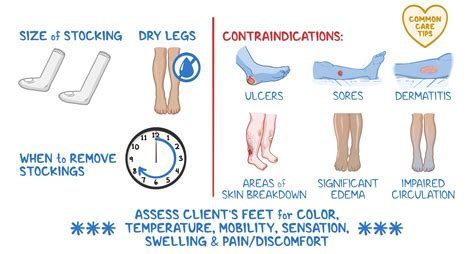 Applying Antiembolic Stockings And Sequential Compression Devices