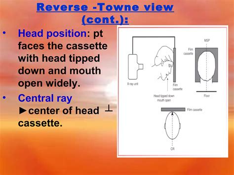 Extra Oral Radiology Techniques Ii Ppt