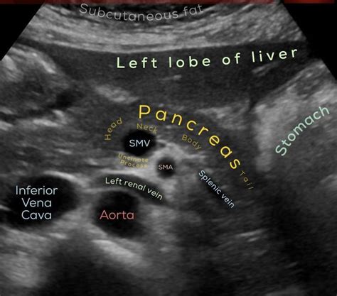 Pin By Safprop On Ultrasound Ultrasound School Ultrasound Technician