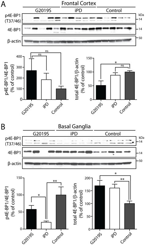 Western Blot Analysis Of A Frontal Cortex Or B Basal Ganglia