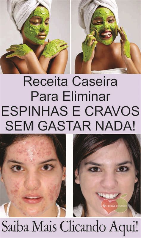 Receita Caseira Para Eliminar ESPINHAS E CRAVOS Sem Gastar Nada Como