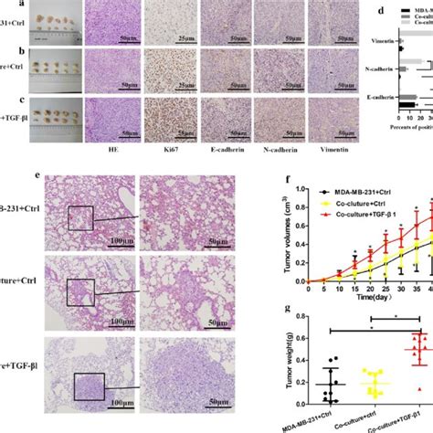 Clinical Information For Invasive Ductal Carcinoma Idc And Ductal